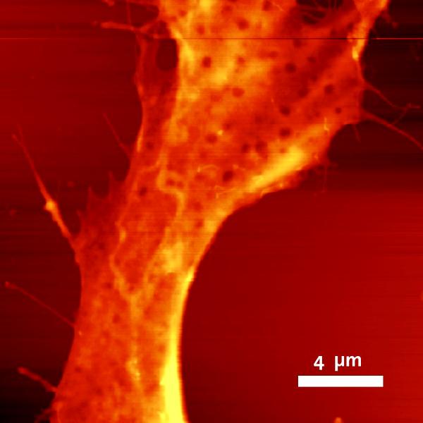AFM image of a HeLa cell.