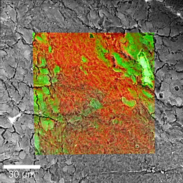 RISE Microscopy (Raman-SEM) image of a brain tissue.